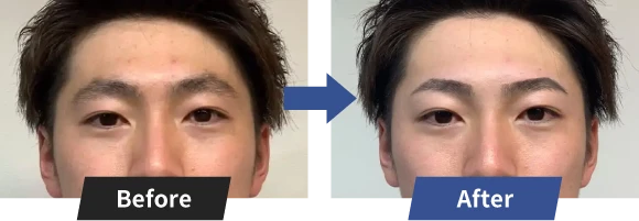 施術ビフォーアフター