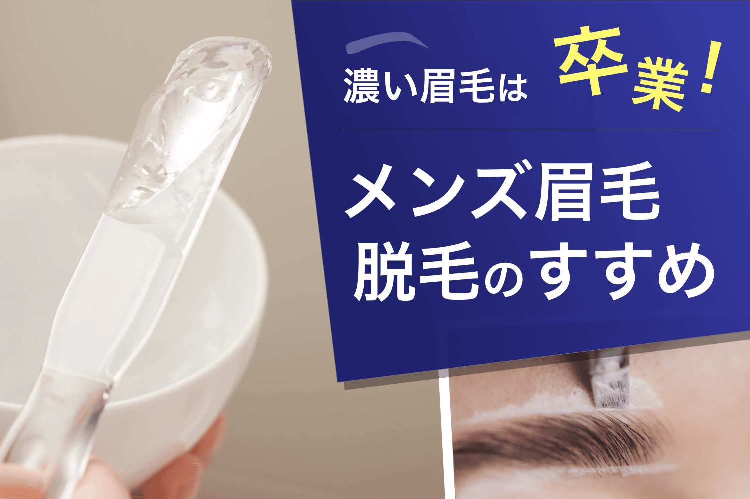 濃い眉毛は卒業！メンズ眉毛脱毛のすすめ