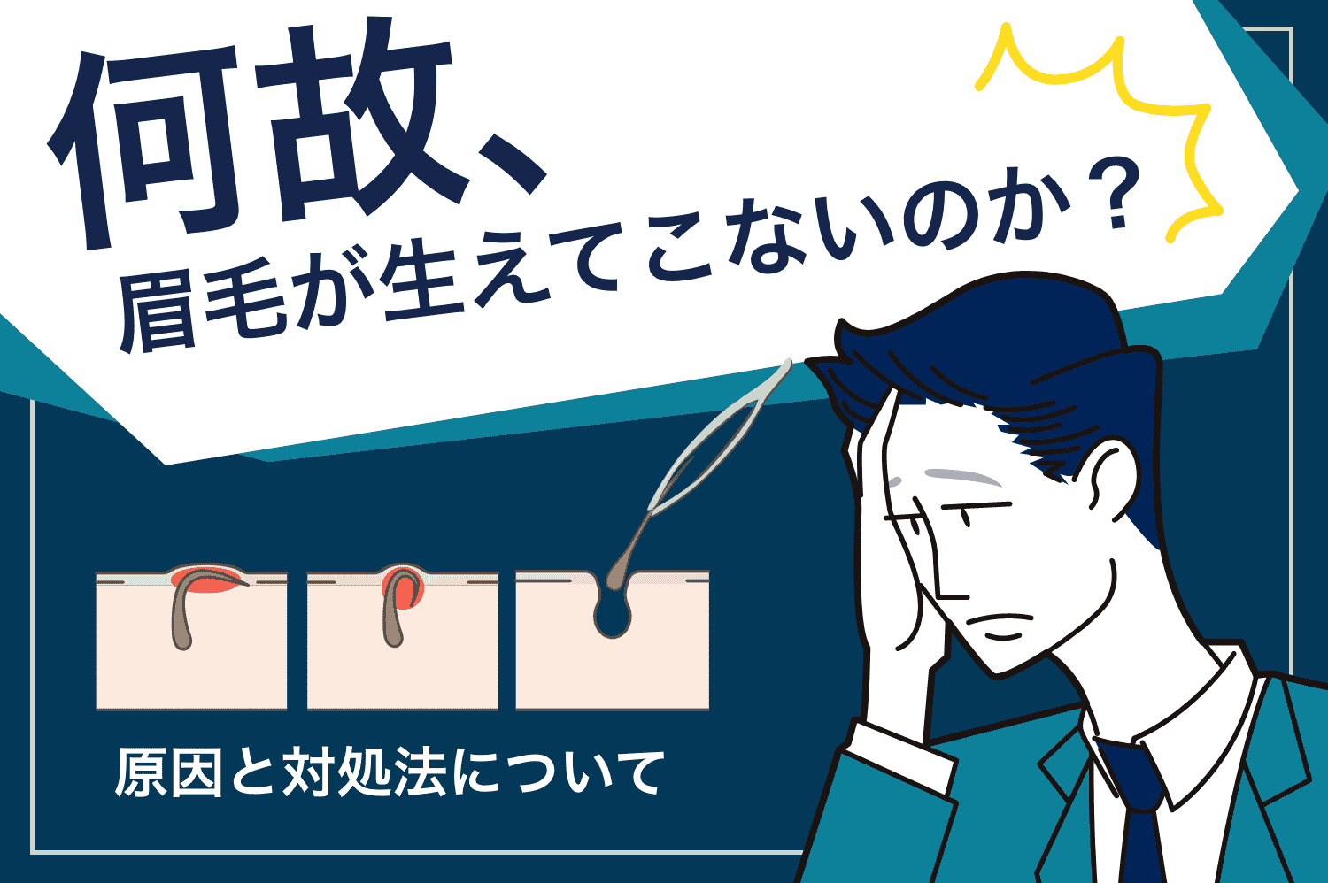 何故、眉毛が生えてこないのか？原因と対処法について